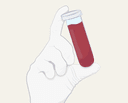 Understanding the Tests for PCOS